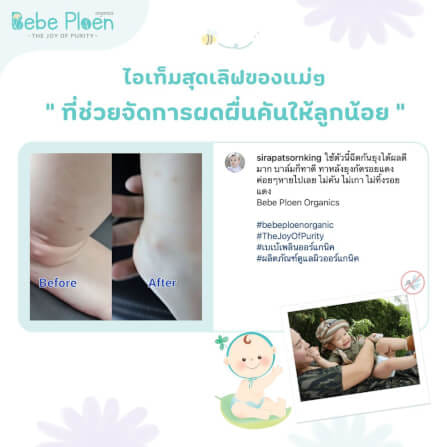 บาล์มทาหลังยุงและแมลงกัดต่อย เบเบ้ เพลินออร์แกนิค_6